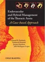 Endovascular Hybrid Management of the Thoracic Aorta: A Case-based Approach артикул 644c.